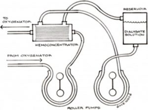 The dialysis system consisted of a standard hemoconcentrator 10 with the dialysis solution flowing countercurrent through it.