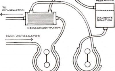 Induced Hyperkalemic Arrest vs. Ventricular Fibrillation for Minimally Invasive MVR