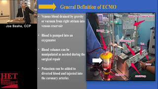 Extracorporeal Membrane Oxygenation Therapy (ECMO Training) Extracorporeal life support